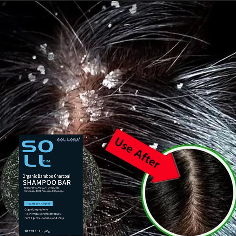 Veloce Antiforfora Trattamento - Hair Care Dandruff recensione e prezzo